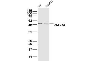Lane 1: TT lysates Lane 2: hepg2 lysates probed with ZNF763 Polyclonal Antibody, Unconjugated  at 1:300 dilution and 4˚C overnight incubation. (ZNF763 Antikörper  (AA 301-394))