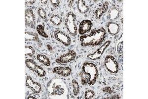 Immunohistochemical staining of human kidney with KCNE3 polyclonal antibody  shows strong cytoplasmic positivity in granular pattern in tubular cells at 1:500-1:1000 dilution. (Kcne3 Antikörper)