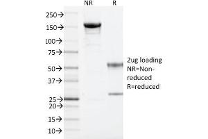 SDS-PAGE Analysis Purified ARF1 Mouse Monoclonal Antibody (ARF1/2117). (ARF1 Antikörper)