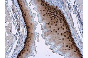 Immunohistochemistry (IHC) image for anti-SRY (Sex Determining Region Y)-Box 2 (SOX2) antibody (ABIN2855074)