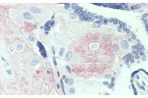 Detection of FGL2 in Human Placenta Tissue using Polyclonal Antibody to Fibrinogen Like Protein 2 (FGL2) (FGL2 Antikörper  (AA 20-432))