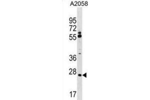 Western Blotting (WB) image for anti-Canopy 3 Homolog (CNPY3) antibody (ABIN5019952) (TNRC5 Antikörper)