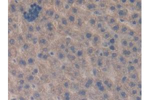 DAB staining on IHC-P; Samples: Rat Liver Tissue