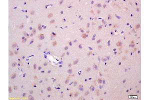 Immunohistochemistry (IHC) image for anti-Wingless-Type MMTV Integration Site Family, Member 1 (WNT1) (AA 251-350) antibody (ABIN733748)