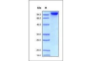 Human CD31, Fc Tag on SDS-PAGE under reducing (R) condition. (CD31 Protein (AA 28-601) (Fc Tag))