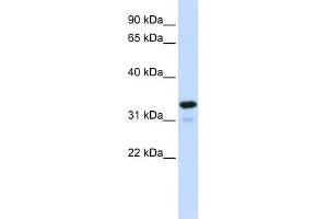 WB Suggested Anti-NFKBIA Antibody Titration:  0. (NFKBIA Antikörper  (Middle Region))