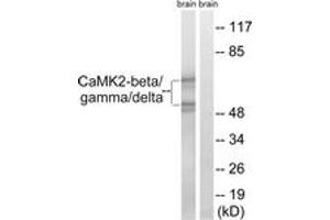 Western blot analysis of extracts from rat brain cells, using CaMK2-beta/gamma/delta (Ab-287) Antibody. (CaMK2 beta/gamma/delta (AA 253-302) Antikörper)