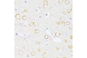 Immunohistochemistry of paraffin-embedded rat brain using Casp8 antibody. (Caspase 8 Antikörper)