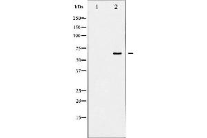 Western Blotting (WB) image for anti-SHC (Src Homology 2 Domain Containing) Transforming Protein 1 (SHC1) (pTyr427) antibody (ABIN6255915)