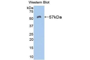 Western blot analysis of the recombinant protein. (ALDH7A1 Antikörper  (AA 29-539))
