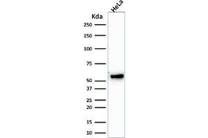 Western Blot Analysis of human HeLa cell lysate using Cytokeratin 7 Mouse Monoclonal Antibody (KRT7/1198). (Cytokeratin 7 Antikörper)