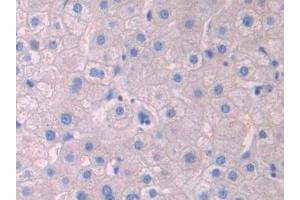 Detection of LCAT in Human Liver Tissue using Polyclonal Antibody to Lecithin Cholesterol Acyltransferase (LCAT) (LCAT Antikörper  (AA 290-433))