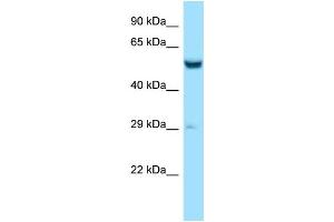 Western Blotting (WB) image for anti-Zinc Finger CCCH-Type Containing 10 (ZC3H10) (N-Term) antibody (ABIN2788533) (ZC3H10 Antikörper  (N-Term))
