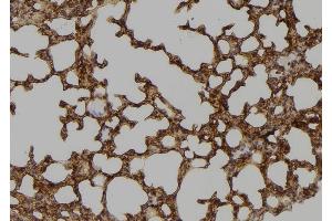 ABIN6276650 at 1/100 staining Mouse lung tissue by IHC-P. (TYR Antikörper  (C-Term))