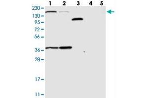 Western blot analysis of Lane 1: RT-4, Lane 2: U-251 MG, Lane 3: Human Plasma, Lane 4: Liver, Lane 5: Tonsil with SAMD9 polyclonal antibody  at 1:250-1:500 dilution.