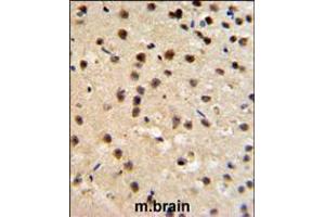 Immunohistochemistry (IHC) image for anti-FK506 Binding Protein 10, 65 KDa (FKBP10) (AA 57-87), (N-Term) antibody (ABIN5531170)