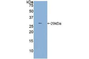Western blot analysis of recombinant Rat TLR4. (TLR4 Antikörper  (AA 49-247))