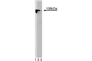 Western blot analysis of SATB1 on a Jurkat cell lysate (Human T-cell leukemia, ATCC TIB-152). (SATB1 Antikörper  (AA 550-667))