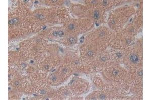 Detection of NT5C3 in Human Liver Tissue using Polyclonal Antibody to 5'-Nucleotidase, Cytosolic III (NT5C3)