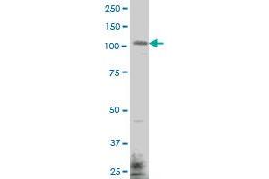 EHMT1 monoclonal antibody (M04), clone 1H2 Western Blot analysis of EHMT1 expression in MES-SA/Dx5 . (EHMT1 Antikörper  (AA 1-100))