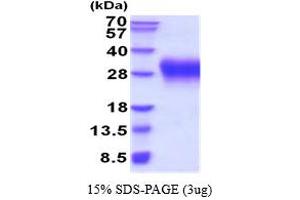 SDS-PAGE (SDS) image for V-type immunoglobulin domain-containing suppressor of T-cell activation (VISTA) (AA 33-194) protein (His tag) (ABIN5854456) (VISTA Protein (AA 33-194) (His tag))