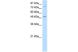 WB Suggested Anti-FOXB1 Antibody Titration:  5.