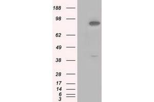 Image no. 4 for anti-Betaine--Homocysteine S-Methyltransferase (BHMT) antibody (ABIN1496917) (BHMT Antikörper)