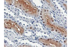Immunohistochemical staining of paraffin-embedded Human Kidney tissue using anti-SHPK mouse monoclonal antibody. (SHPK Antikörper)