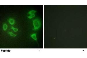 Immunofluorescence analysis of HepG2 cells, using ZAK polyclonal antibody . (ZAK Antikörper  (C-Term))