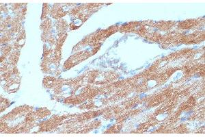 Immunohistochemistry of paraffin-embedded Mouse heart using ACSL3 Polyclonal Antibody at dilution of 1:100 (40x lens).