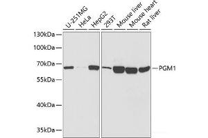 Western blot analysis of extracts of various cell lines using PGM1 Polyclonal Antibody at dilution of 1:1000. (Phosphoglucomutase 1 Antikörper)