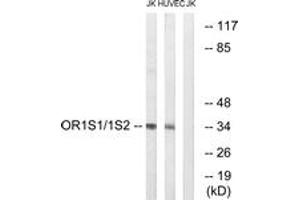 Western blot analysis of extracts from Jurkat/HuvEc cells, using OR1S1/1S2 Antibody. (OR1S1/1S2 Antikörper  (AA 241-290))