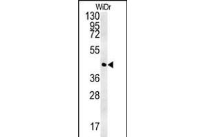 CCNYL1 Antikörper  (N-Term)