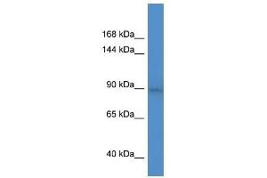 BCL11A antibody used at 0. (BCL11A Antikörper  (C-Term))