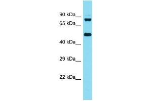 Western Blotting (WB) image for anti-Kelch Repeat and BTB (POZ) Domain Containing 6 (KBTBD6) (N-Term) antibody (ABIN2791601)