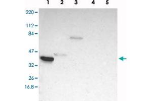 Western blot analysis of Lane 1: RT-4, Lane 2: U-251 MG, Lane 3: Human Plasma, Lane 4: Liver, Lane 5: Tonsil with TFAP4 polyclonal antibody . (TFAP4 Antikörper)