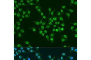 Immunofluorescence analysis of U2OS cells using KLF4 Polyclonal Antibody at dilution of 1:100. (KLF4 Antikörper)