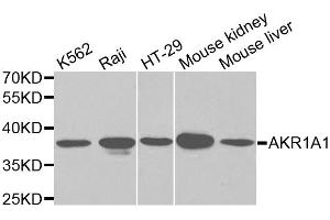 Western blot analysis of extracts of various cell lines, using AKR1A1 antibody (ABIN5970427) at 1/1000 dilution. (AKR1A1 Antikörper)