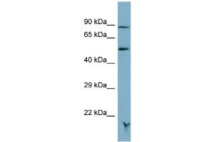 Host:  Rabbit  Target Name:  MRAP  Sample Type:  OVCAR-3 Whole cell lysates  Antibody Dilution:  1. (MRAP Antikörper  (N-Term))
