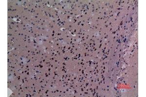 Immunohistochemistry (IHC) analysis of paraffin-embedded Mouse Brain, antibody was diluted at 1:100. (SND1 Antikörper  (Internal Region))