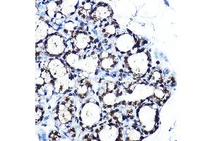Immunohistochemistry of paraffin-embedded rat brown adipose using PPARγ Rabbit pAb (ABIN6134090, ABIN6146004, ABIN6146006 and ABIN6215096) at dilution of 1:250 (40x lens).