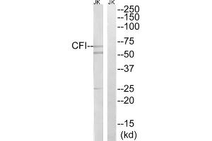 Western blot analysis of extracts from Jurkat cells, using CFI antibody. (Complement Factor I Antikörper  (Internal Region))