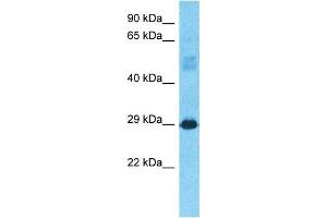 Host:  Rabbit  Target Name:  CJ076  Sample Type:  Fetal Liver lysates  Antibody Dilution:  1. (C10orf76 Antikörper  (C-Term))