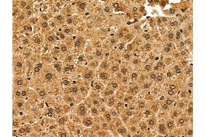ABIN6259696 and ABIN6276936 at 1/100 staining Mouse liver tissue by IHC-P.