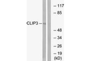 Western Blotting (WB) image for anti-CAP-GLY Domain Containing Linker Protein 3 (CLIP3) (AA 361-410) antibody (ABIN2890180) (CLIP3 Antikörper  (AA 361-410))
