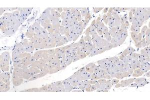 Immunohistochemistry (IHC) image for anti-Natriuretic Peptides B (NPPB) (AA 27-134) antibody (ABIN7445450)