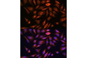 Immunofluorescence analysis of HeLa cells using FBP1 Rabbit mAb (ABIN7267269) at dilution of 1:100 (40x lens). (FBP1 Antikörper)