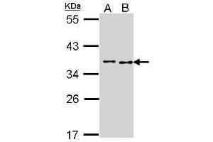 WB Image Sample (30 ug of whole cell lysate) A: A431 , B: Hela 10% SDS PAGE antibody diluted at 1:1000 (BCCIP Antikörper  (C-Term))
