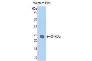 Western Blotting (WB) image for anti-Keratin 1 (KRT1) (AA 350-488) antibody (ABIN1172987) (Cytokeratin 1 Antikörper  (AA 350-488))