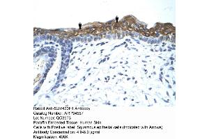 Rabbit Anti-SUV420H1 Antibody  Paraffin Embedded Tissue: Human Skin Cellular Data: Squamous epithelial cells Antibody Concentration: 4. (SUV420H1 Antikörper  (Middle Region))